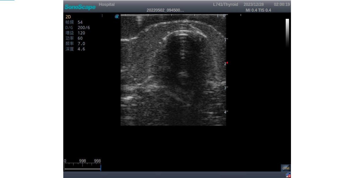 Thyroid Ultrasound Training Model